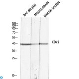 CD72 Antibody - Western Blot (WB) analysis of specific cells using Antibody diluted at 1:1000.