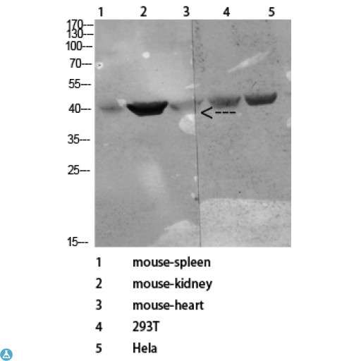 CD72 Antibody - Western Blot (WB) analysis of Rat Spleen Mouse Brain Mouse Spleen lysis using CD72 antibody.