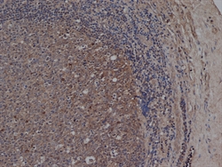 CD72 Antibody - Staining of paraffin-embedded human tonsil with Mouse anti-Human CD72 (MOUSE ANTI HUMAN CD72).