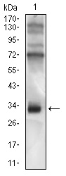 CD74 / CLIP Antibody - Western blot using CD74 mouse monoclonal antibody against Raji cell lysate.