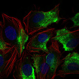 CD74 / CLIP Antibody - Immunofluorescence of HeLa cells using CD74 mouse monoclonal antibody (green). Blue: DRAQ5 fluorescent DNA dye.