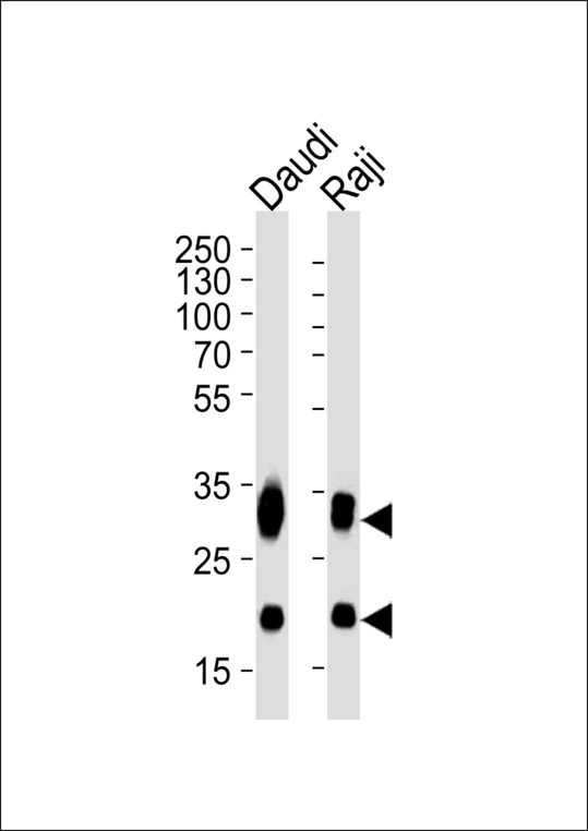 CD74 / CLIP Antibody - Western blot of lysates from Daudi, Raji cell line (from left to right) with CD74 Antibody. Antibody was diluted at 1:1000 at each lane. A goat anti-mouse IgG H&L (HRP) at 1:5000 dilution was used as the secondary antibody. Lysates at 35 ug per lane.