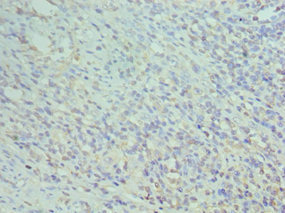 CD74 / CLIP Antibody - Immunohistochemistry of paraffin-embedded human epityphlon tissue using CD74 Antibody at dilution of 1:100