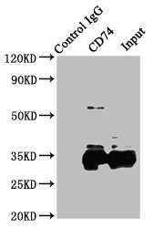 CD74 / CLIP Antibody - Immunoprecipitating CD74 in Raji whole cell lysate Lane 1: Rabbit control IgG instead of CD74 Antibody in Raji whole cell lysate.For western blotting, a HRP-conjugated Protein G antibody was used as the secondary antibody (1/2000) Lane 2: CD74 Antibody (8µg) + Raji whole cell lysate (500µg) Lane 3: Raji whole cell lysate (10µg)