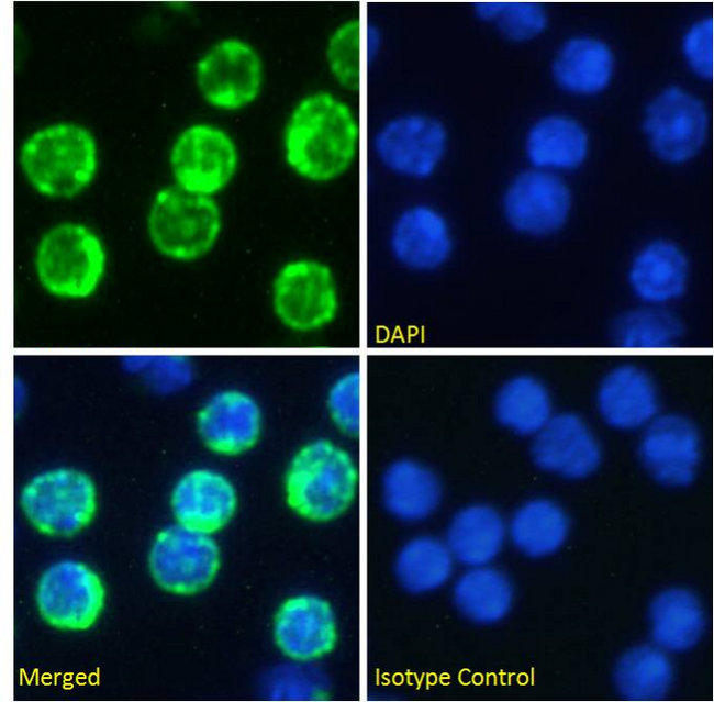 CD74 / CLIP Antibody - IF staining of mouse splenocytes.