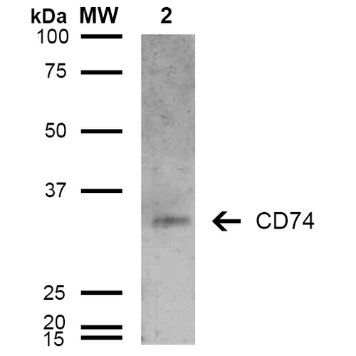 CD74 / CLIP Antibody - Western Blot analysis of Human Lymphoblastoid cell line (Raji) showing detection of 33-35 kDa CD74 protein using Mouse Anti-CD74 Monoclonal Antibody, Clone 6D9. Lane 1: Molecular Weight Ladder (MW). Lane 2: Raji cell lysate. Load: 15 µg. Block: 5% Skim Milk in TBST. Primary Antibody: Mouse Anti-CD74 Monoclonal Antibody  at 1:1000 for 2 hours at RT. Secondary Antibody: Goat Anti-Mouse IgG: HRP at 1:1000 for 60 min at RT. Color Development: ECL solution for 5 min in RT. Predicted/Observed Size: 33-35 kDa.
