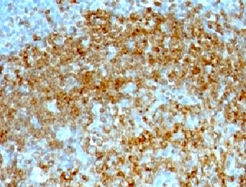 CD74 / CLIP Antibody - IHC testing of FFPE human tonsil with CD74 antibody (clone CDLA74-1).  This image was taken for the unmodified form of this product. Other forms have not been tested.