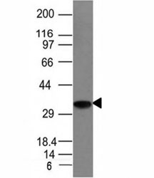 CD74 / CLIP Antibody - Western blot analysis of Raji cell lysate using CLIP antibody (CLIP/1133).  This image was taken for the unmodified form of this product. Other forms have not been tested.