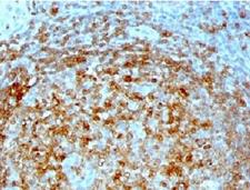 CD74 / CLIP Antibody - IHC analysis of formalin/paraffin human tonsil with CLIP antibody (CLIP/813).  This image was taken for the unmodified form of this product. Other forms have not been tested.