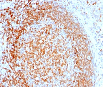 CD74 / CLIP Antibody - CD74 antibody LN-2 immunohistochemistry tonsil-1 This image was taken for the unmodified form of this product. Other forms have not been tested.