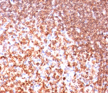 CD74 / CLIP Antibody - CD74 antibody LN-2 immunohistochemistry tonsil-2 This image was taken for the unmodified form of this product. Other forms have not been tested.