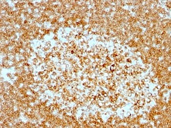 CD74 / CLIP Antibody - Formalin-fixed, paraffin-embedded human tonsil stained with CD74 antibody (LN-2 + CLIP/813).  This image was taken for the unmodified form of this product. Other forms have not been tested.