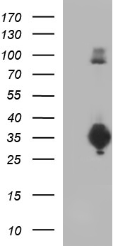 CD74 / CLIP Antibody - HEK293T cells were transfected with the pCMV6-ENTRY control (Left lane) or pCMV6-ENTRY CD74 (Right lane) cDNA for 48 hrs and lysed. Equivalent amounts of cell lysates (5 ug per lane) were separated by SDS-PAGE and immunoblotted with anti-CD74.