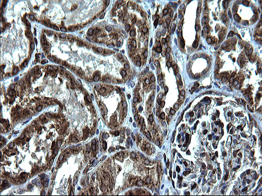 CD74 / CLIP Antibody - IHC of paraffin-embedded Human Kidney tissue using anti-CD74 mouse monoclonal antibody. (Heat-induced epitope retrieval by 1 mM EDTA in 10mM Tris, pH8.5, 120°C for 3min).