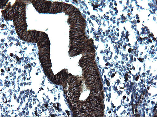 CD74 / CLIP Antibody - IHC of paraffin-embedded Human endometrium tissue using anti-CD74 mouse monoclonal antibody. (Heat-induced epitope retrieval by 1 mM EDTA in 10mM Tris, pH8.5, 120°C for 3min).