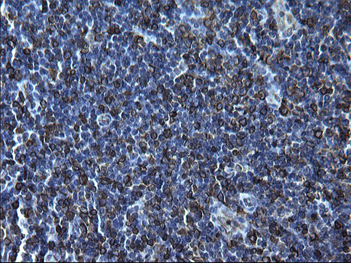 CD74 / CLIP Antibody - IHC of paraffin-embedded Human lymph node tissue using anti-CD74 mouse monoclonal antibody. (Heat-induced epitope retrieval by 1 mM EDTA in 10mM Tris, pH8.5, 120°C for 3min).
