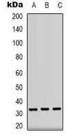 CD74 / CLIP Antibody - Western blot analysis of CD74 expression in Ramos (A); Raji (B); PC12 (C) whole cell lysates.