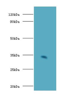 CD74 / CLIP Antibody - Western blot of H-2 class II histocompatibility antigen gamma chain antibody at 2 ug/ml with mouse spleen tissue Secondary Goat polyclonal to Rabbit IgG at 1:15000 dilution. Predicted band size: 34 KDa. Observed band size: 34 KDa.  This image was taken for the unconjugated form of this product. Other forms have not been tested.