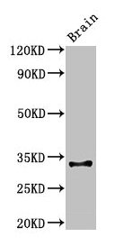 CD74 / CLIP Antibody - Western Blot Positive WB detected in: mouse brain tissue All lanes: Cd74 antibody at 3µg/ml Secondary Goat polyclonal to rabbit IgG at 1/50000 dilution Predicted band size: 32, 25 kDa Observed band size: 32 kDa