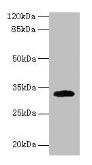 CD74 / CLIP Antibody - Western blot All lanes: H-2 class II histocompatibility antigen gamma chain antibody at 2µg/ml + Mouse lung tissue Secondary Goat polyclonal to rabbit IgG at 1/10000 dilution Predicted band size: 32, 25 kDa Observed band size: 32 kDa