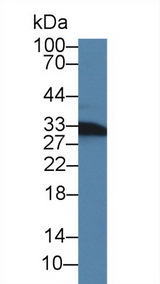 CD74 / CLIP Antibody