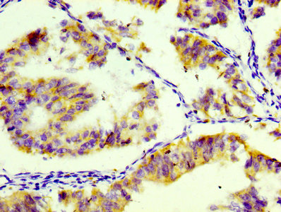 CD74 / CLIP Antibody - Immunohistochemistry Dilution at 1:100 and staining in paraffin-embedded human endometrial tissue performed on a Leica BondTM system. After dewaxing and hydration, antigen retrieval was mediated by high pressure in a citrate buffer (pH 6.0). Section was blocked with 10% normal Goat serum 30min at RT. Then primary antibody (1% BSA) was incubated at 4°C overnight. The primary is detected by a biotinylated Secondary antibody and visualized using an HRP conjugated SP system.
