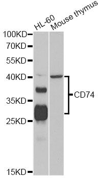 CD74 / CLIP Antibody - Western blot analysis of extracts of various cell lines, using CD74 antibody at 1:1000 dilution. The secondary antibody used was an HRP Goat Anti-Rabbit IgG (H+L) at 1:10000 dilution. Lysates were loaded 25ug per lane and 3% nonfat dry milk in TBST was used for blocking. An ECL Kit was used for detection and the exposure time was 60s.