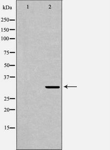 CD74 / CLIP Antibody - Western blot analysis of Raji cell lysates using CD74 antibody. The lane on the left is treated with the antigen-specific peptide.