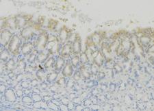 CD74 / CLIP Antibody - 1:100 staining human gastric tissue by IHC-P. The sample was formaldehyde fixed and a heat mediated antigen retrieval step in citrate buffer was performed. The sample was then blocked and incubated with the antibody for 1.5 hours at 22°C. An HRP conjugated goat anti-rabbit antibody was used as the secondary.