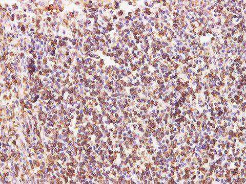 CD74 / CLIP Antibody - Immunohistochemistry of paraffin-embedded Human tonsil using CD74 Polyclonal Antibody at dilution of 1:200.
