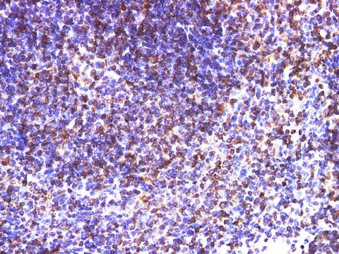 CD74 / CLIP Antibody - Immunohistochemistry of paraffin-embedded Mouse spleen using CD74 Polyclonal Antibody at dilution of 1:200.