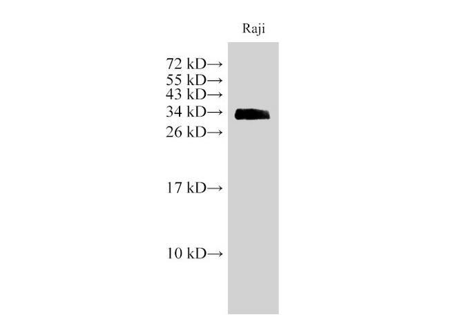CD74 / CLIP Antibody - Western Blot analysis of Raji cells using CD74 Polyclonal Antibody at dilution of 1:1000.