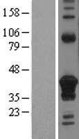 CD74 / CLIP Protein - Western validation with an anti-DDK antibody * L: Control HEK293 lysate R: Over-expression lysate