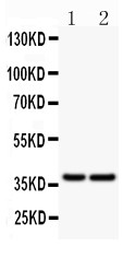 CD79A / CD79 Alpha Antibody - CD79A antibody Western blot. All lanes: Anti CD79a at 0.5 ug/ml. Lane 1: Human Placenta Tissue Lysate at 50 ug. Lane 2: Rat Spleen Tissue Lysate at 50 ug. Predicted band size: 25 kD . Observed band size: 37 kD.