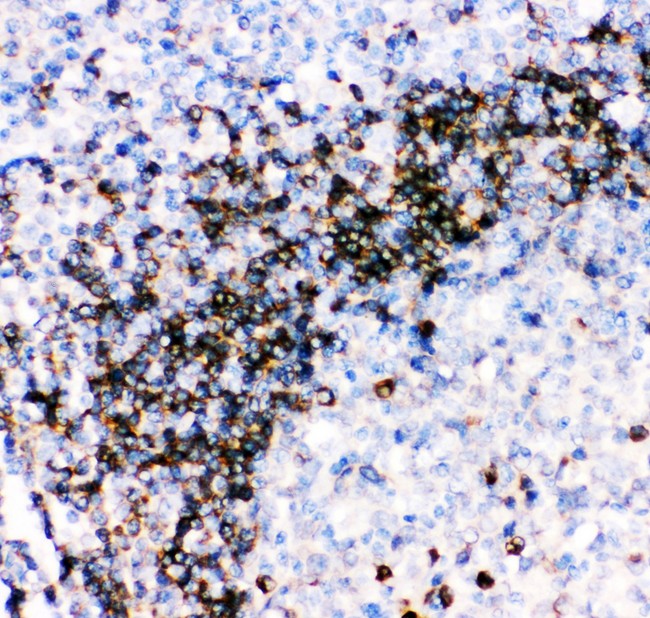 CD79A / CD79 Alpha Antibody - CD79A antibody IHC-paraffin: Human Tonsil Tissue.