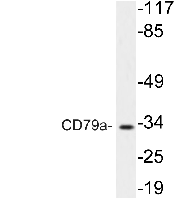 CD79A / CD79 Alpha Antibody - Western blot analysis of lysate from NIH/3T3 cells, using CD79a antibody.