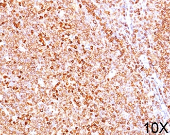 CD79A / CD79 Alpha Antibody - CD79a antibody HM47/A9 immunohistochemistry 10X.  This image was taken for the unmodified form of this product. Other forms have not been tested.