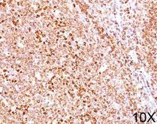CD79A / CD79 Alpha Antibody - CD79a antibody HM47/A9 immunohistochemistry 10X.  This image was taken for the unmodified form of this product. Other forms have not been tested.