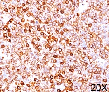 CD79A / CD79 Alpha Antibody - CD79a antibody HM47/A9 immunohistochemistry 20X.  This image was taken for the unmodified form of this product. Other forms have not been tested.