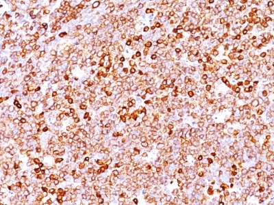 CD79A / CD79 Alpha Antibody - Formalin-fixed, paraffin-embedded human Tonsil stained with CD79a Rabbit Recombinant Monoclonal Antibody (IGA/1688R).