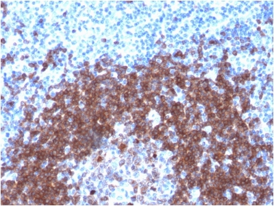 CD79A / CD79 Alpha Antibody - Formalin-fixed, paraffin-embedded human Tonsil stained with CD79a Rabbit Recombinant Monoclonal Antibody (IGA/1790R).
