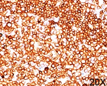 CD79A / CD79 Alpha Antibody - CD79a antibody JCB117 immunohistochemistry tonsil 20X.  This image was taken for the unmodified form of this product. Other forms have not been tested.