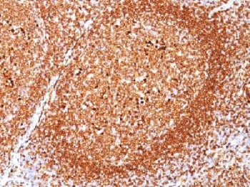 CD79A / CD79 Alpha Antibody - IHC testing of FFPE human tonsil stained with CD79a antibody (clone JCB117). Required HIER: boil tissue sections in 10mM citrate buffer, pH 6.0, for 10-20 min followed by cooling at RT for 20 minutes.