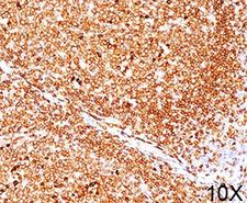 CD79A / CD79 Alpha Antibody - CD79a antibody JCB117 immunohistochemistry tonsil 10X.  This image was taken for the unmodified form of this product. Other forms have not been tested.