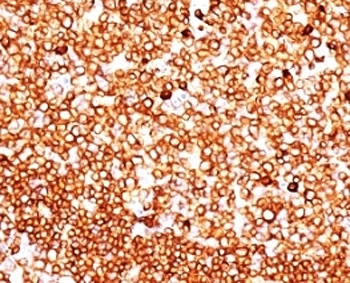CD79A / CD79 Alpha Antibody - Formalin-fixed, paraffin-embedded human tonsil stained with CD79 antibody (SPM549).  This image was taken for the unmodified form of this product. Other forms have not been tested.