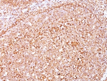 CD79A / CD79 Alpha Antibody - Formalin-fixed, paraffin-embedded human tonsil stained with anti-CD79a antibody (SPM550).  This image was taken for the unmodified form of this product. Other forms have not been tested.