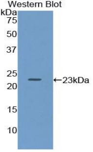 CD79A / CD79 Alpha Antibody - Western blot of recombinant CD79A.  This image was taken for the unconjugated form of this product. Other forms have not been tested.