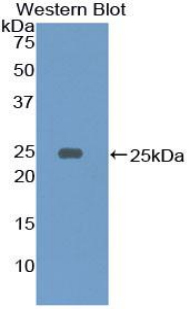 CD79A / CD79 Alpha Antibody - Western blot of recombinant CD79A.  This image was taken for the unconjugated form of this product. Other forms have not been tested.