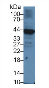 CD79A / CD79 Alpha Antibody - Western Blot; Sample: Human Raji cell lysate; Primary Ab: 1µg/ml Rabbit Anti-Human Iga Antibody Second Ab: 0.2µg/mL HRP-Linked Caprine Anti-Rabbit IgG Polyclonal Antibody
