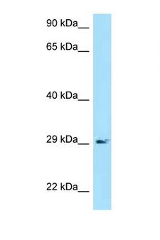 CD79A / CD79 Alpha Antibody - CD79A antibody Western blot of COL0205 Cell lysate. Antibody concentration 1 ug/ml.  This image was taken for the unconjugated form of this product. Other forms have not been tested.